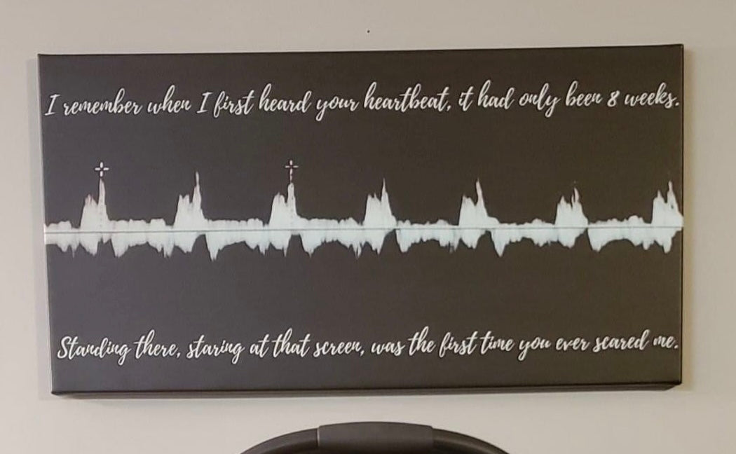 Heartbeat Canvas